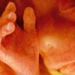 “Planned Parenthood“ und die vollkommen wahnsinnige Rechtsprechung in den USA